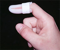 splint