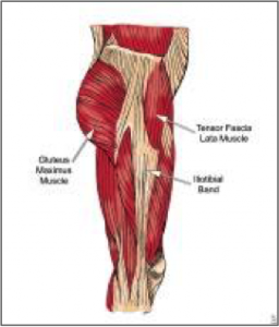 Lateral hip stabilizers.